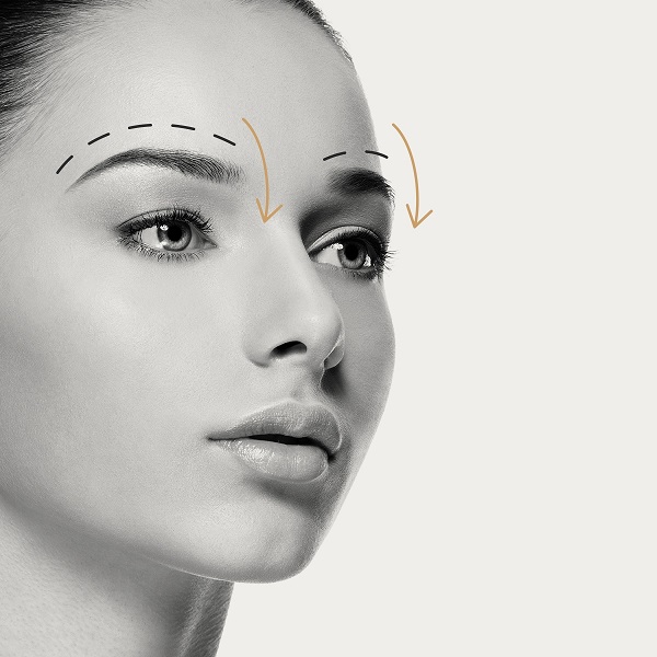 Trasplante capilar de cejas con Livet