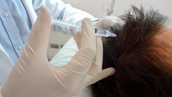 Mesoterapia con fármacos