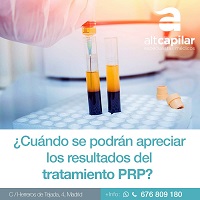 Tratamiento con PRP