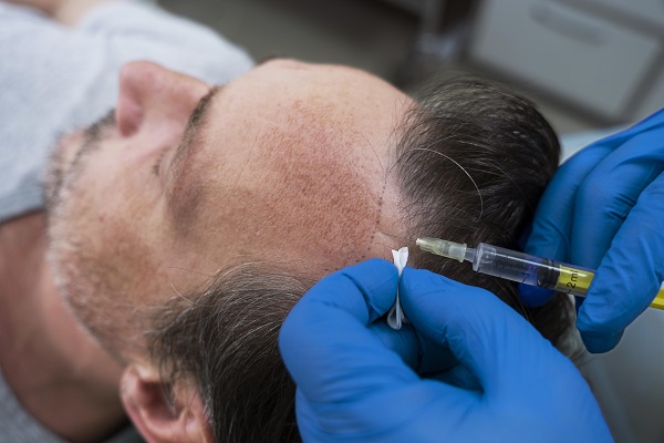 Sesión con paciente de bioestimulación capilar