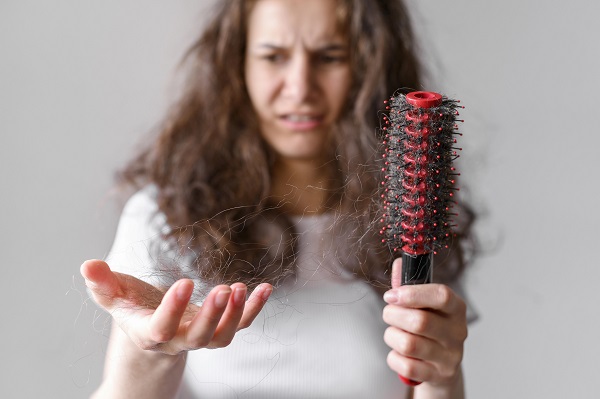 Síntomas de la alopecia areata